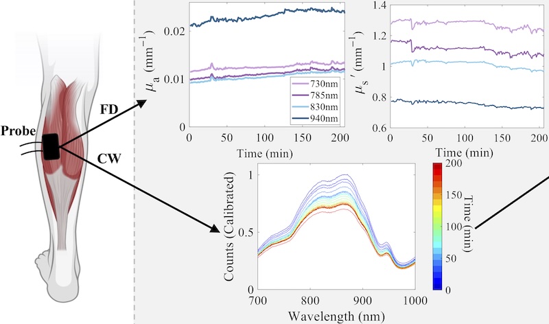 A new noninvasive optical method tracks real‑time changes in tissue water during hemodialysis, offering a potential early warning system for treatment‑related complications. Credit: D. Suciu/Biophotonics Discovery.