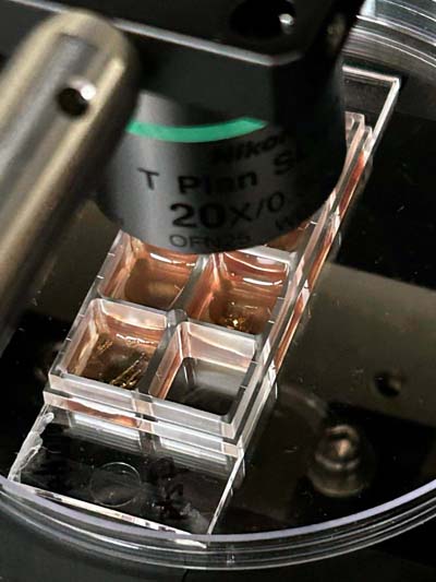 A sensor placed in a wound model with bacterial growth is examined. Photo courtesy of Aditya Garg.