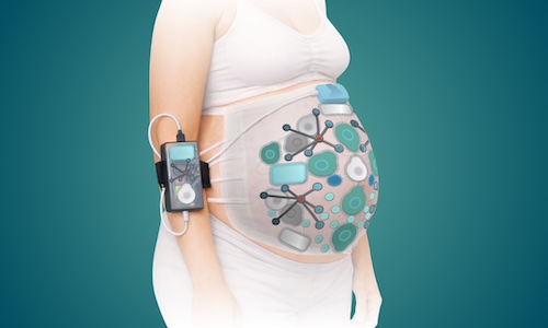 The OMEGA device will monitor health data on the mother, fetus, uterus and placenta. Credit: Carnegie Mellon University.