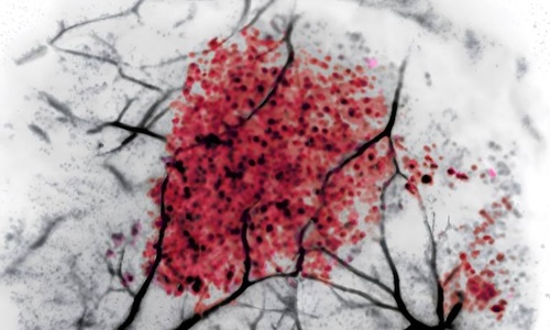 UCL photoacoustic imaging maps microplastics in living tissue