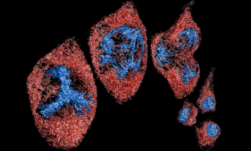 UC Berkeley multimodal platform shows details of subcellular dynamics