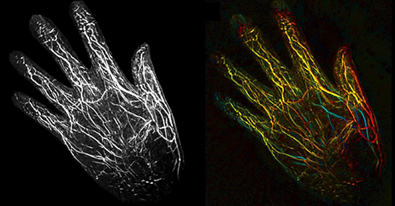Improved photoacoustic imaging could help identify disease or monitor post-operative recovery. Credit: Caltech.