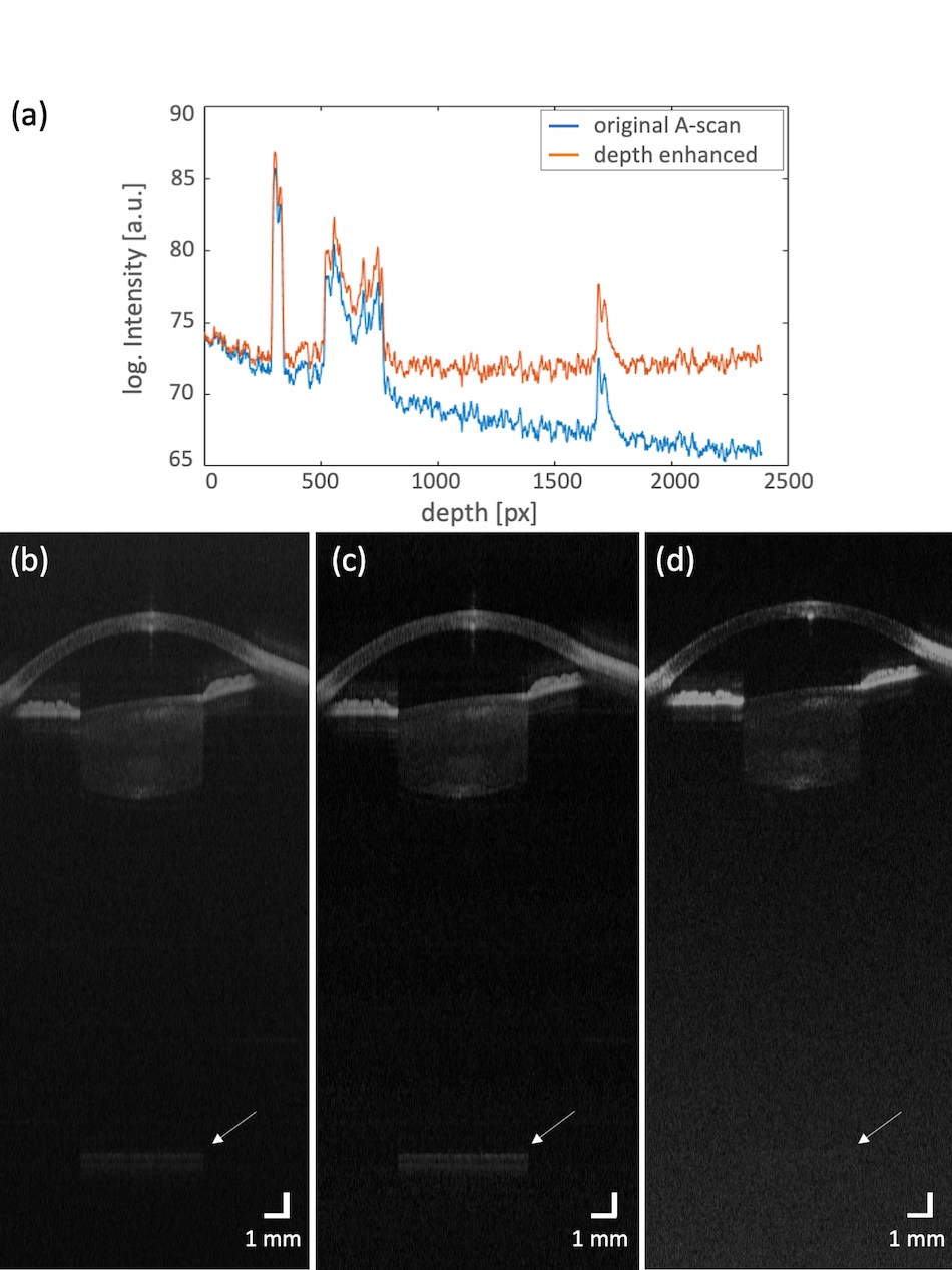 Researchers have shown that a VCSEL diode could offer a less expensive light source for swept-source OCT. Advanced post-processing algorithms were used to improve the resulting images. Credit: Milana Kendrisic/Medical University of Vienna.
