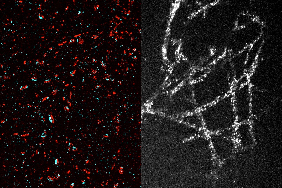 Thanks to a new technique that allows them to expand tissue 20-fold before imaging it, MIT researchers used a conventional light microscope to generate high-resolution images of synapses (left) and microtubules (right). In the image at left, presynaptic proteins are labeled in red, and postsynaptic proteins are labeled in blue. Each blue-red 