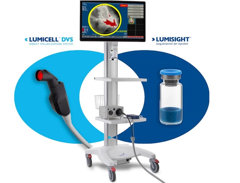 The combination of Lumisight imaging agent and Lumicell DVS instrument is designed to identify breast cancer tumors. The company is now developing its technology for other cancers as well. Credit: Lumicell.