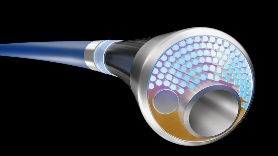 A clinical trial is underway to assess the Philips platform. Credit: Philips.