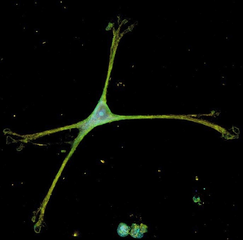 An astrocyte on the novel nanowire platform. Credit: Johns Hopkins University.
