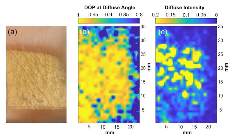 Polarimetric measurements of terahertz scattering can detect subtle changes in tissue architecture that result from disease or damage. For example, terahertz measurements demonstrated signal contrast between burned and healthy skin regions. Credit: Stony Brook University/Journal of Biomedical Optics.