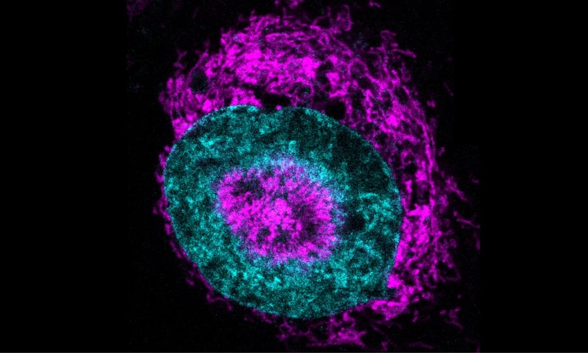 A confined cancer cell, where the mitochondria (in magenta) can be seen accumulating at the nuclear periphery (nucleus shown in cyan) and within nuclear 'dimples' (indentations). Credit: Rito Ghose & Fabio Pezzano/Centre for Genomic Regulation.