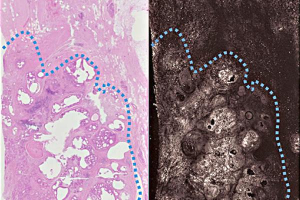UV-PAM (right) produces images as detailed and accurate as traditional methods (left), but in far less time. Credit: Terence T.W. Wong.