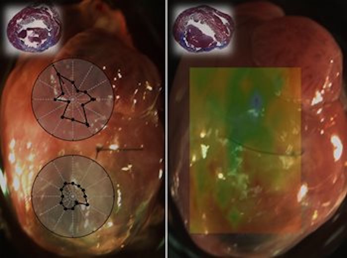 Left: Direction-dependent differences between healthy (top) and damaged tissue (bottom) in the heart. Right: Spatially resolved tissue stiffness measurements obtained with OCE. Green areas are healthy, yellow and red areas are damaged regions with decreased elasticity. Credit:  Kirill Larin of University of Houston.