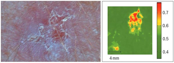 Medical uses of THz radiation