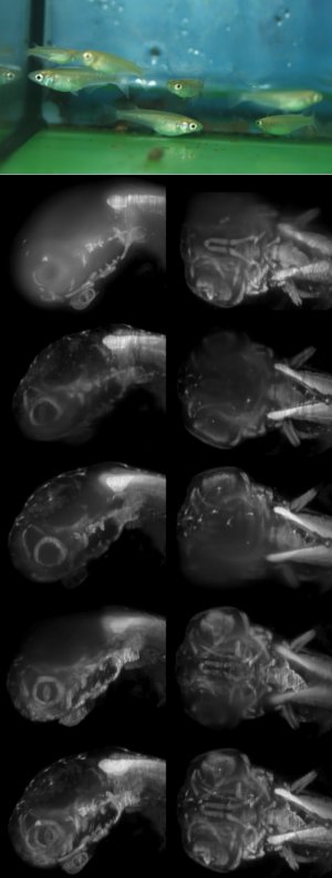 Microscope images of a four day old Medaka fish embryo