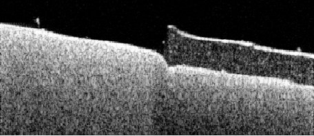 OCT cross-section