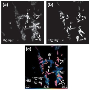 Images of bacteria Images of bacteria