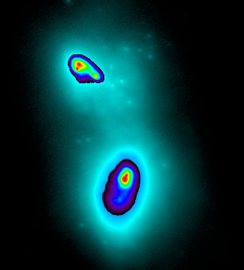 Supermassive black holes Two black holes have been pinpointed at the center of a collision of two galaxies thanks to adaptive optics at the Keck Observatory.