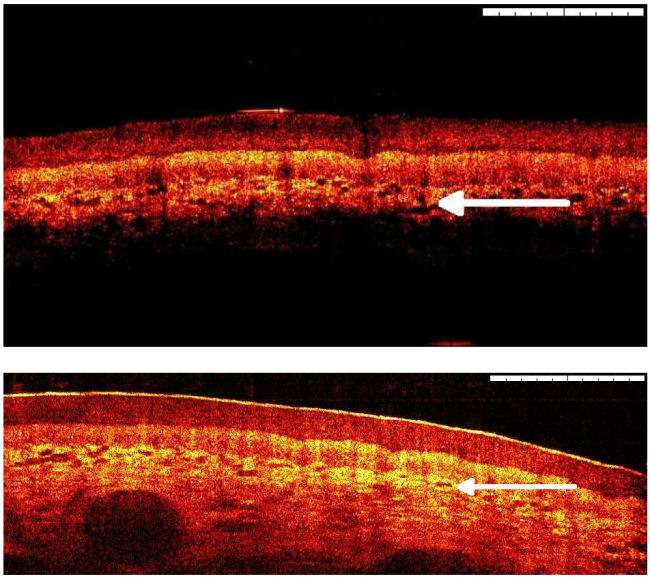 comparing OCT images at 1 and 1.3 microns