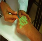 VeinViewer guiding blood sample