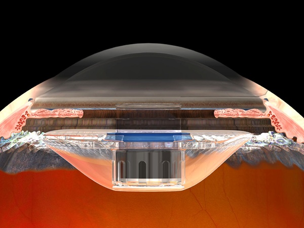 Profile view - schematic
