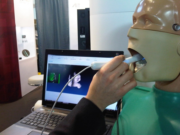 3D dental scanner 3D dental scanner