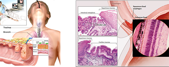 Imaging with light instead of radioactivity leads to 100x greater sharpness.