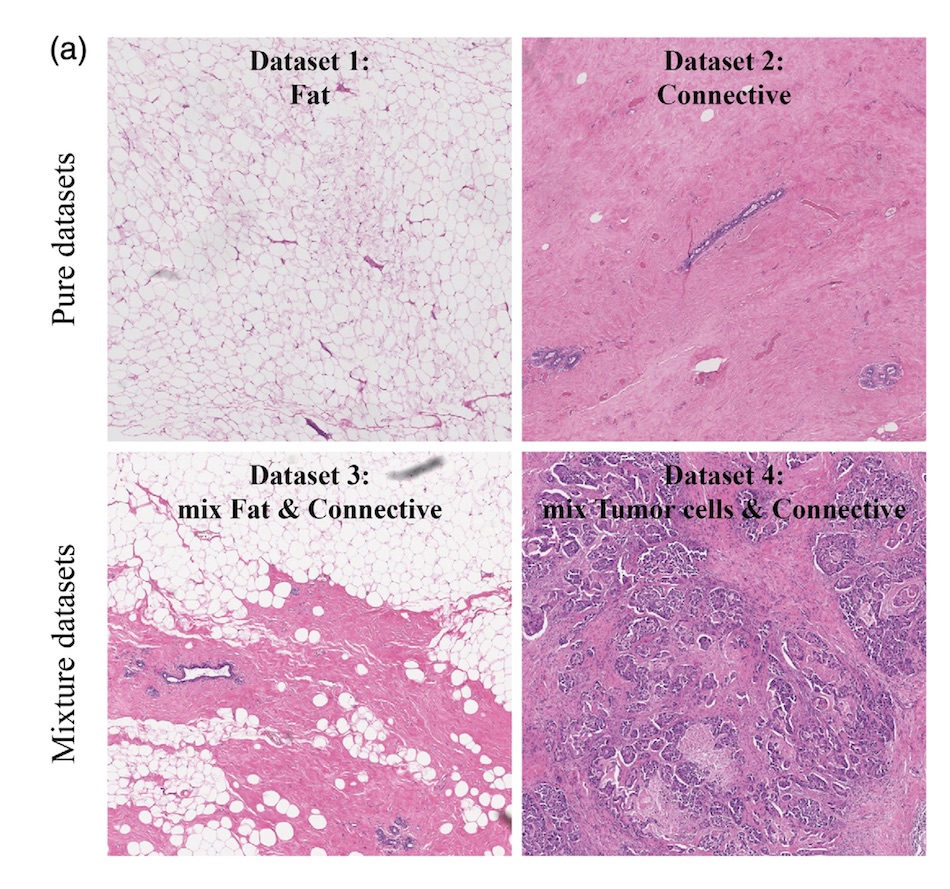 Regions of interest: histopathology and DRS spectra 