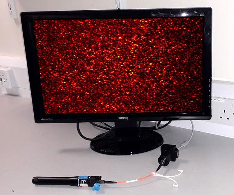 Speckle: potentially useful in a wavemeter