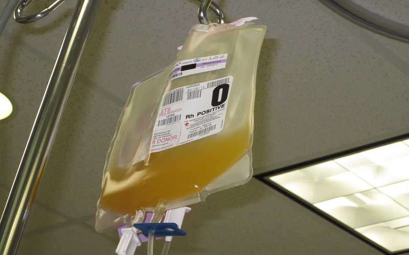 Platelet transfusion
