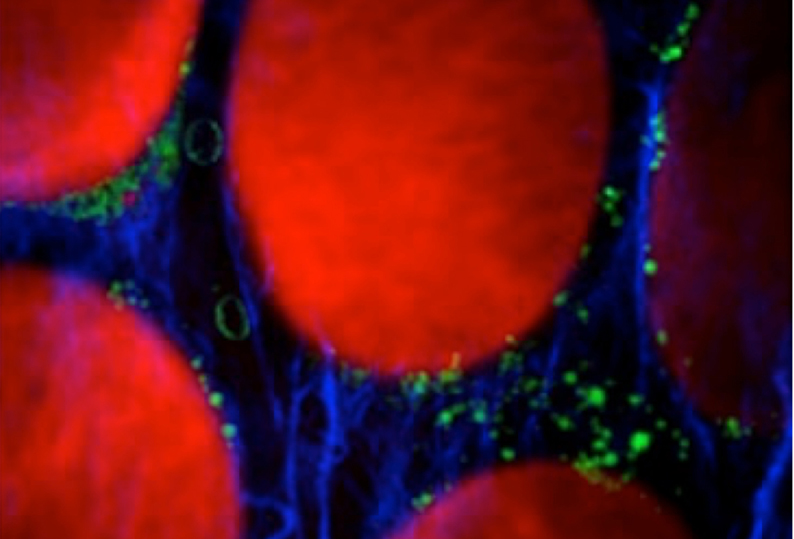 Cancer challenge: CARMEN aims to integrate three imaging methods.