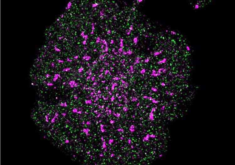 Looking closely: direct distance measurements