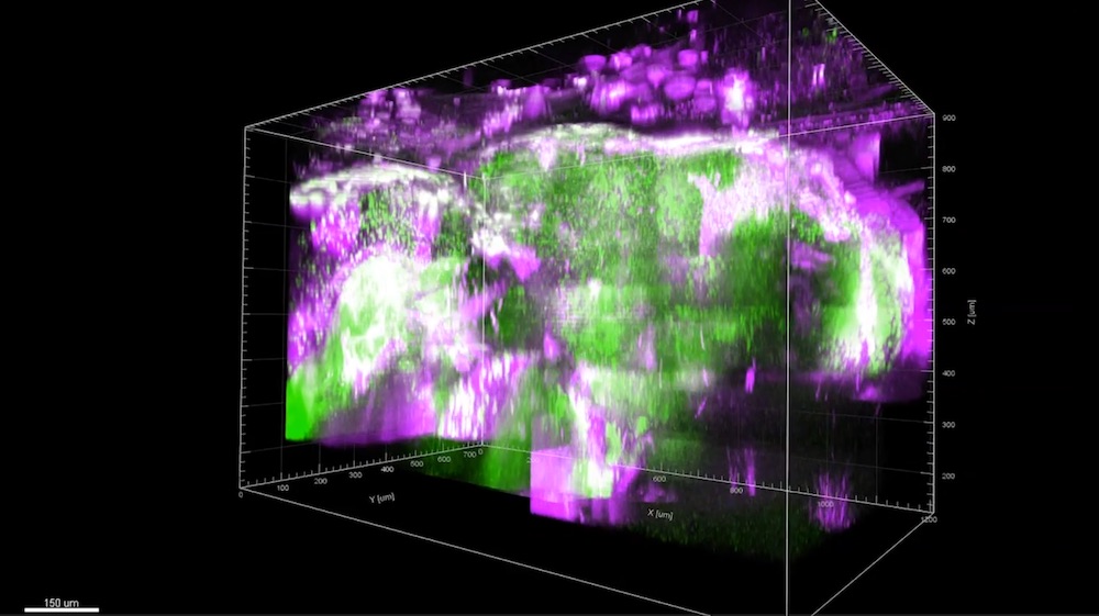 Adult zebrafish brain: valuable insight