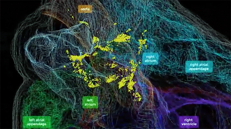 Heart of the matter: The 3D map revealed hitherto unknown complexity of the ICN. Click for more info.