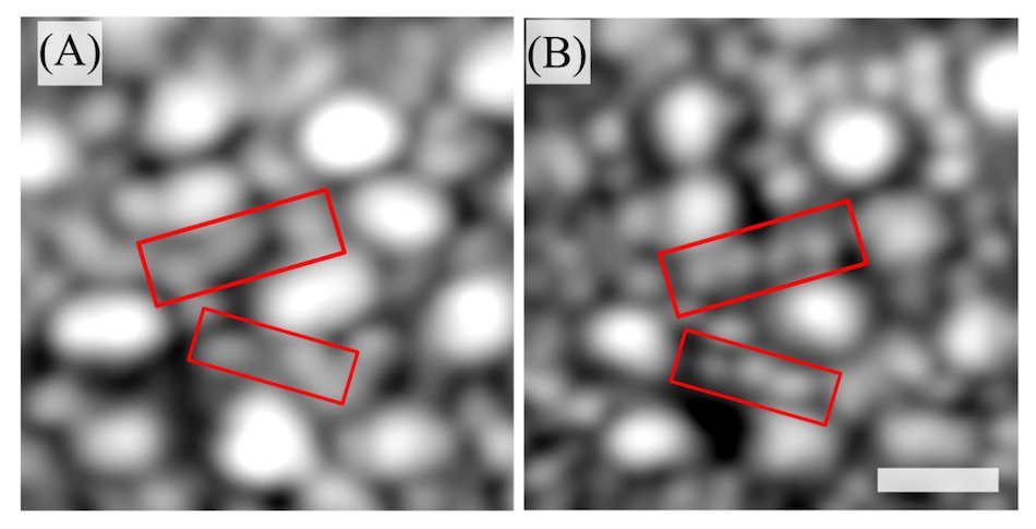 Rods resolved in greater detail