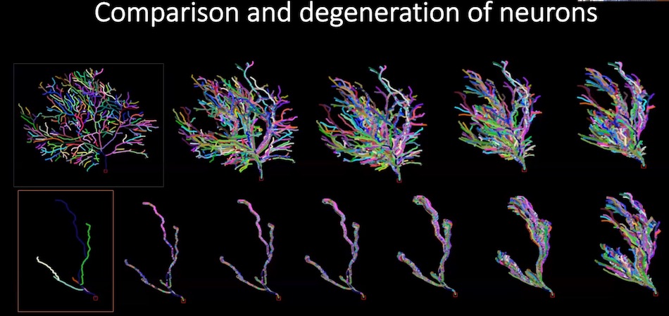 Brain activity: neural networks