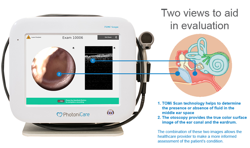 Earlier this year, the FDA granted clearance for the TOMi Scope. Click to expand.