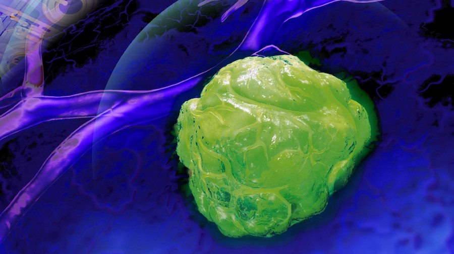 Seeing the margins: detection of tumor location