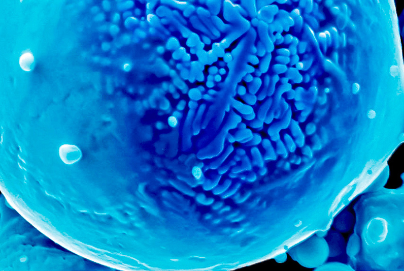 Colorized electron micrograph of a nickel powder alloy from the study.