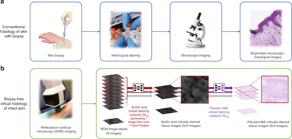 Image analysis: faster diagnosis