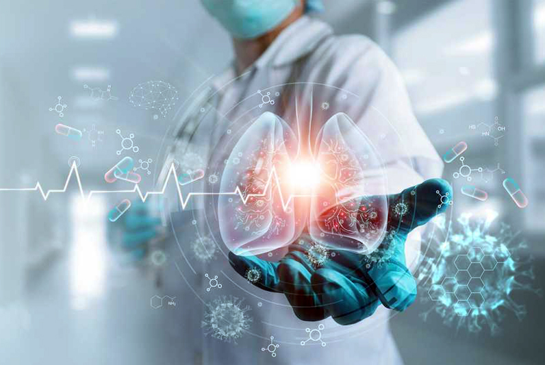 Icovid supports radiologists in the assessment of CT images of Covid-19 patients.