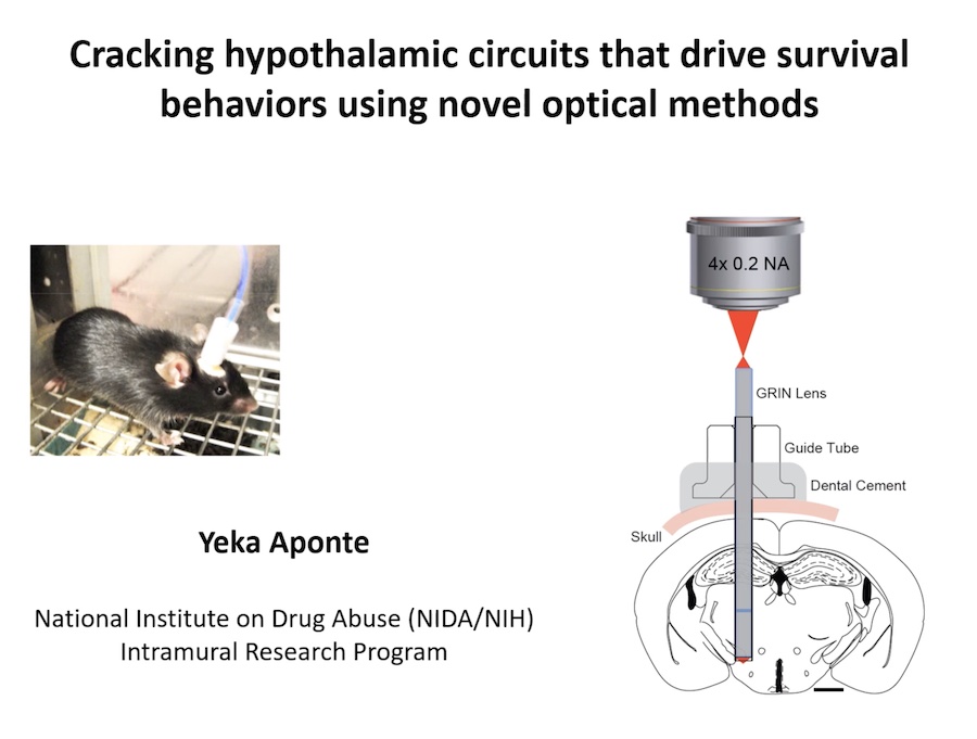 Pain and gain: the brain's response