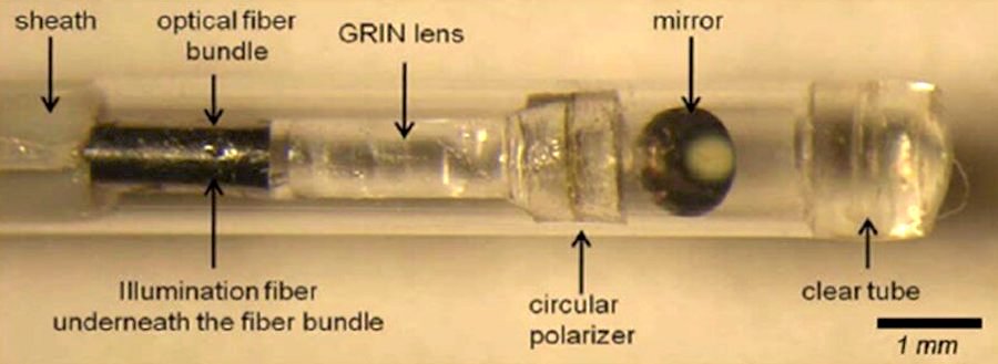 Plaque analysis: spotting potential danger