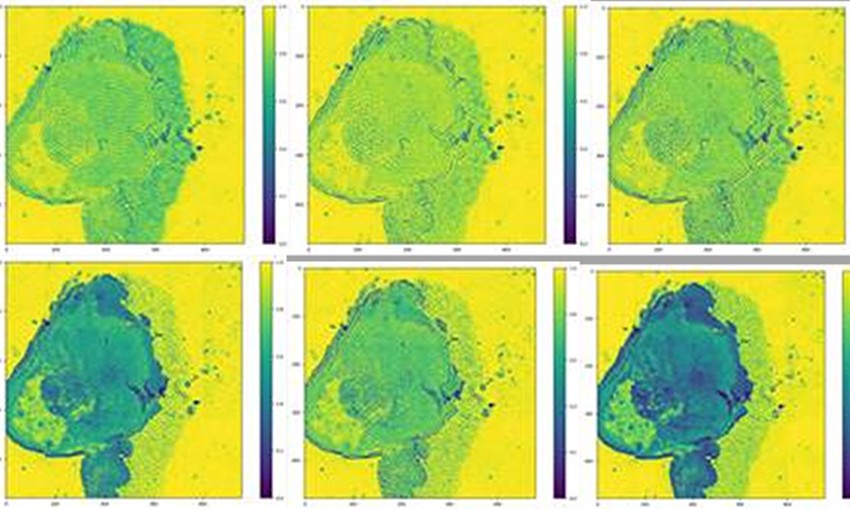 Infrared imaging to spot cancer cells
