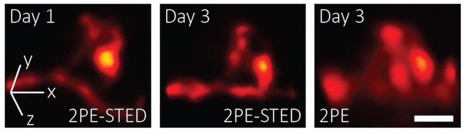 Spot the difference: 3D STED