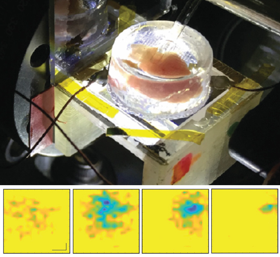 Imaging of live embryo heart