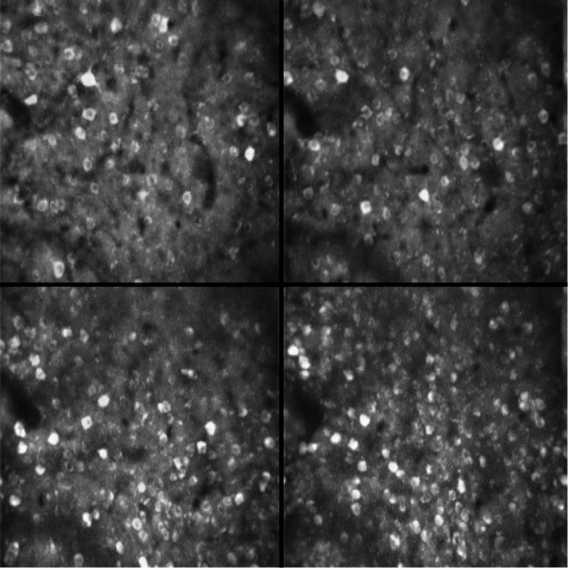 Large cell populations: MINI2P imaging