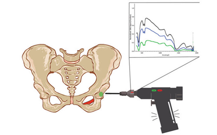 Close to the bone: optical technology