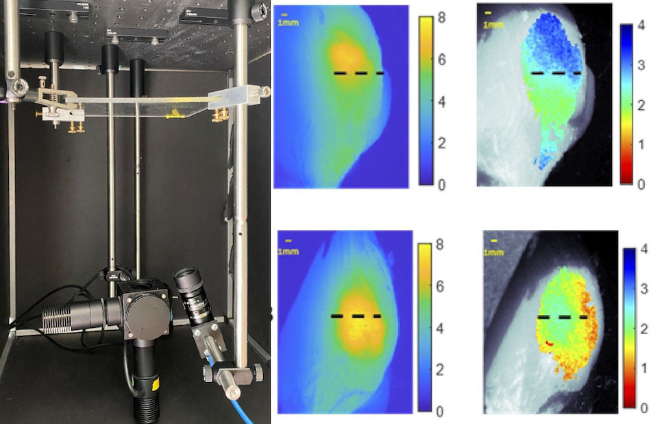 Margin call: tumor depth