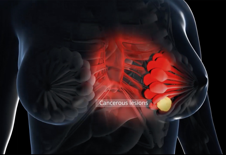 OAI provides new insights into a variety of diseases.