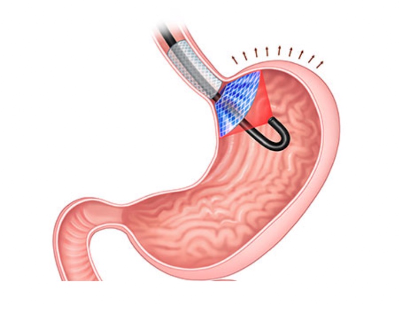 Hunger game: light-controlled appetite Hunger game: light-controlled appetite