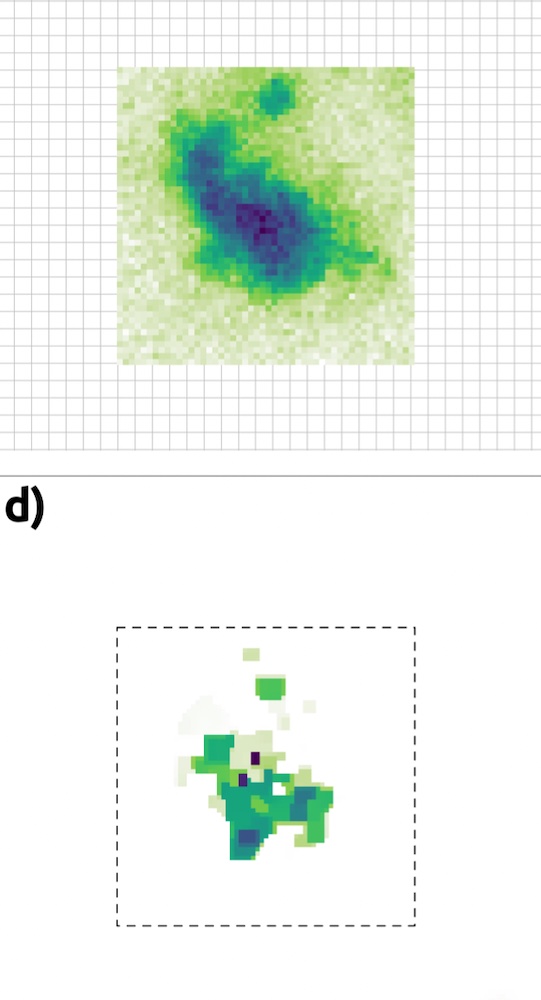Imaging disease progress: speckle put to use